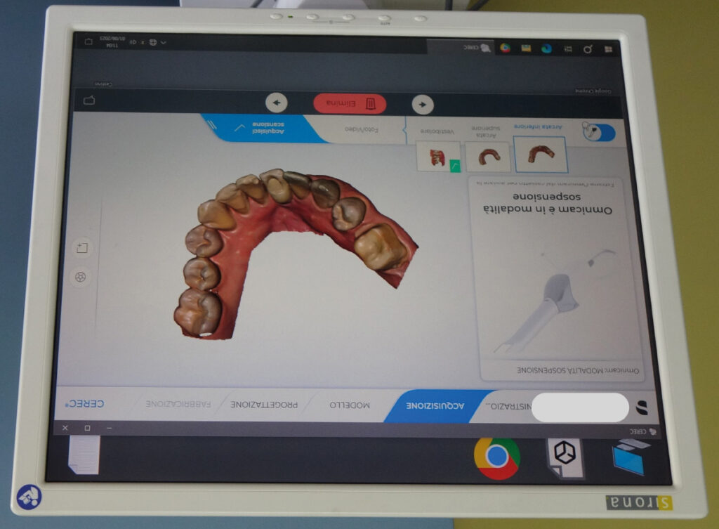 fig 3b Immagine sul monitor di una impronta digitale