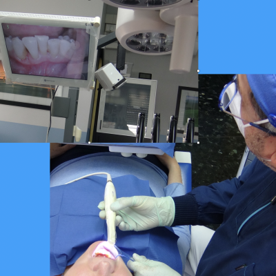 fig 5 Videocamera intraorale digitale per migliorare spiegazioni e diagnosi