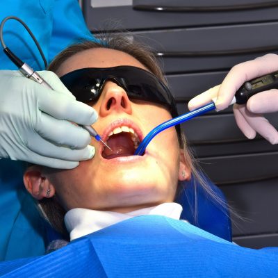 fig 8 Laser in funzione